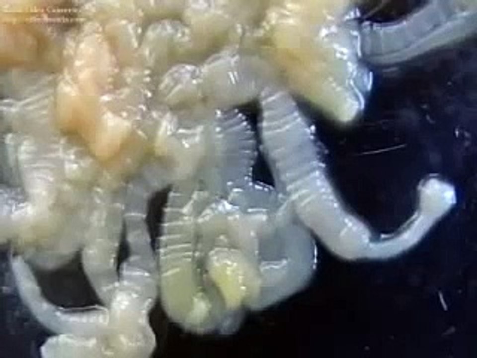 Taenia solium