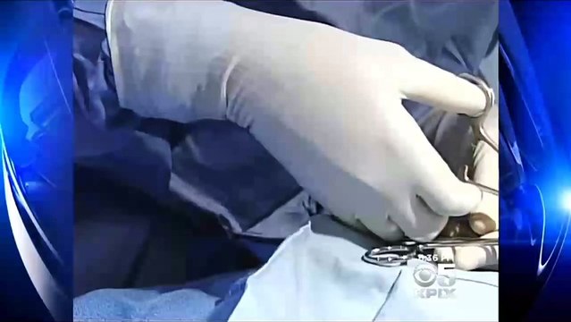 CDC: Circumcision Benefits Trump Risks And Health Insurers Should Pay For It