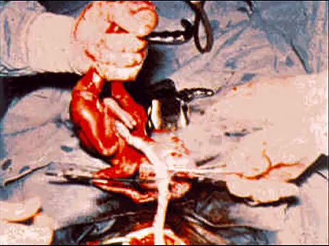 The End Times, The Second Coming of Jesus Christ to Earth