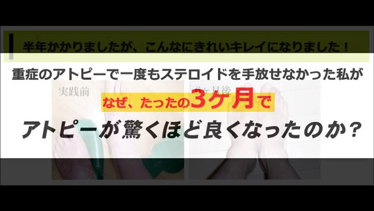 ★アトピー性皮膚炎、克服・改善法＠薬を使わずに自宅で出来る＠