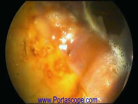 Equine Endoscopy Endoscope using a PVS3M PortaScope