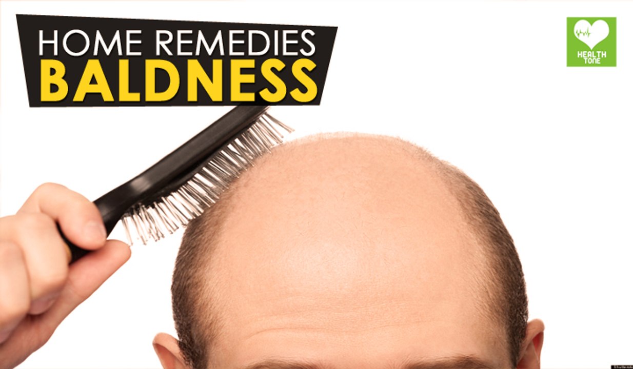 Baldness - Home Remedies | Health Tone Tips