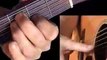 Acoustic Guitar Lessons | Guitar Lessons For Beginners
