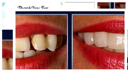 Find The Best Orthodontist Near Lake Worth