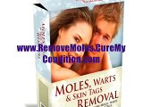 How To Remove Skin Tags, Moles and Warts At Home Naturally Without Any Surgery - Step by Step Guide