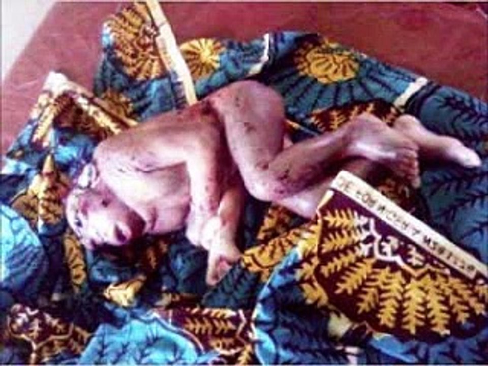 Strange world!! Woman gives birth to monkey like baby in Kaduna Viewers Discretion)