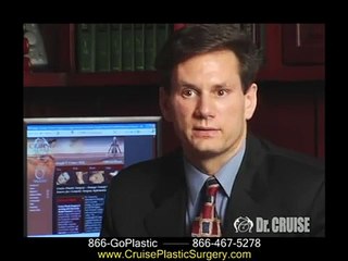 Breast Augmentation (silicone), 36A to 36D, Dr. Cruise