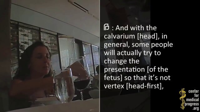 Doctor explains how she Harvests Fetal Organs For Sale - Planned Parenthood