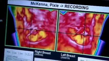 Embarrassing Bodies BreastHealth UK