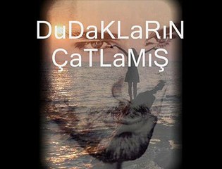 Video-dudaklarım çatlamış-Beyhan Aydogan'in