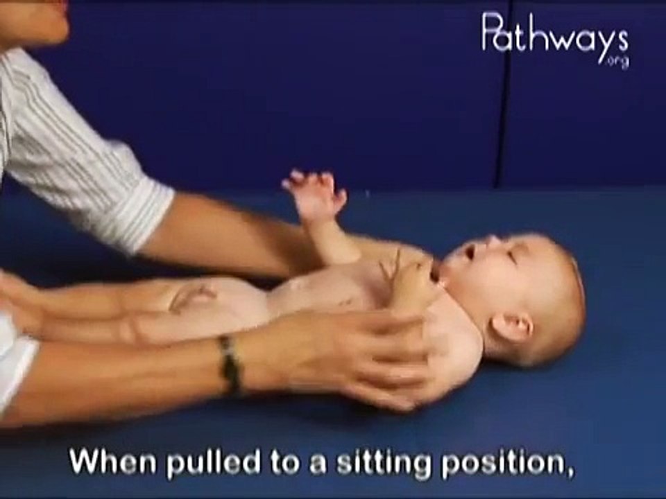 6 Month Old Babies in Pull to Sit Movement,  Typical and Atypical Development Comparison