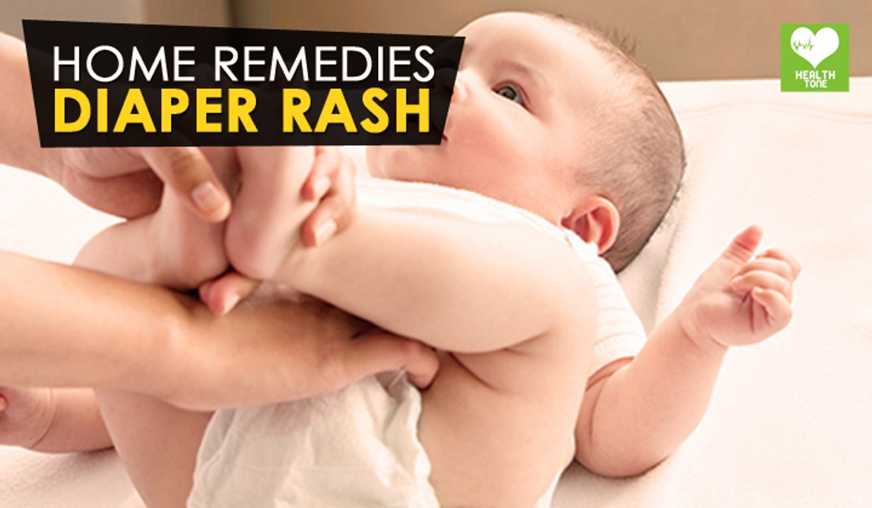 Diaper Rash - Home Remedies | Health Tone Tips