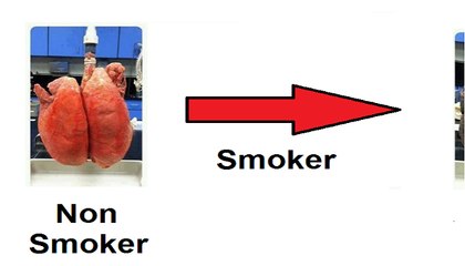 How smoking damages your lungs