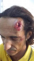 ‫#‏معتمد‬ يفتح رأس مواطن فرنسي في ‫#‏الحمامات‬