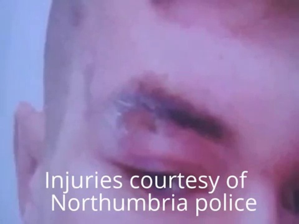 Beaten up by Northumbria Police - see description