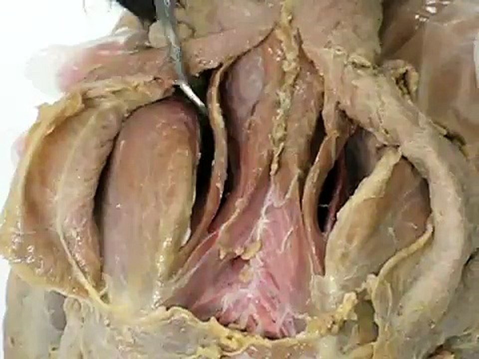 CAT DISSECTION 4