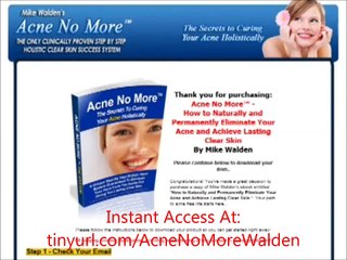 (Review) Acne No More Mike Walden (Acne No More)