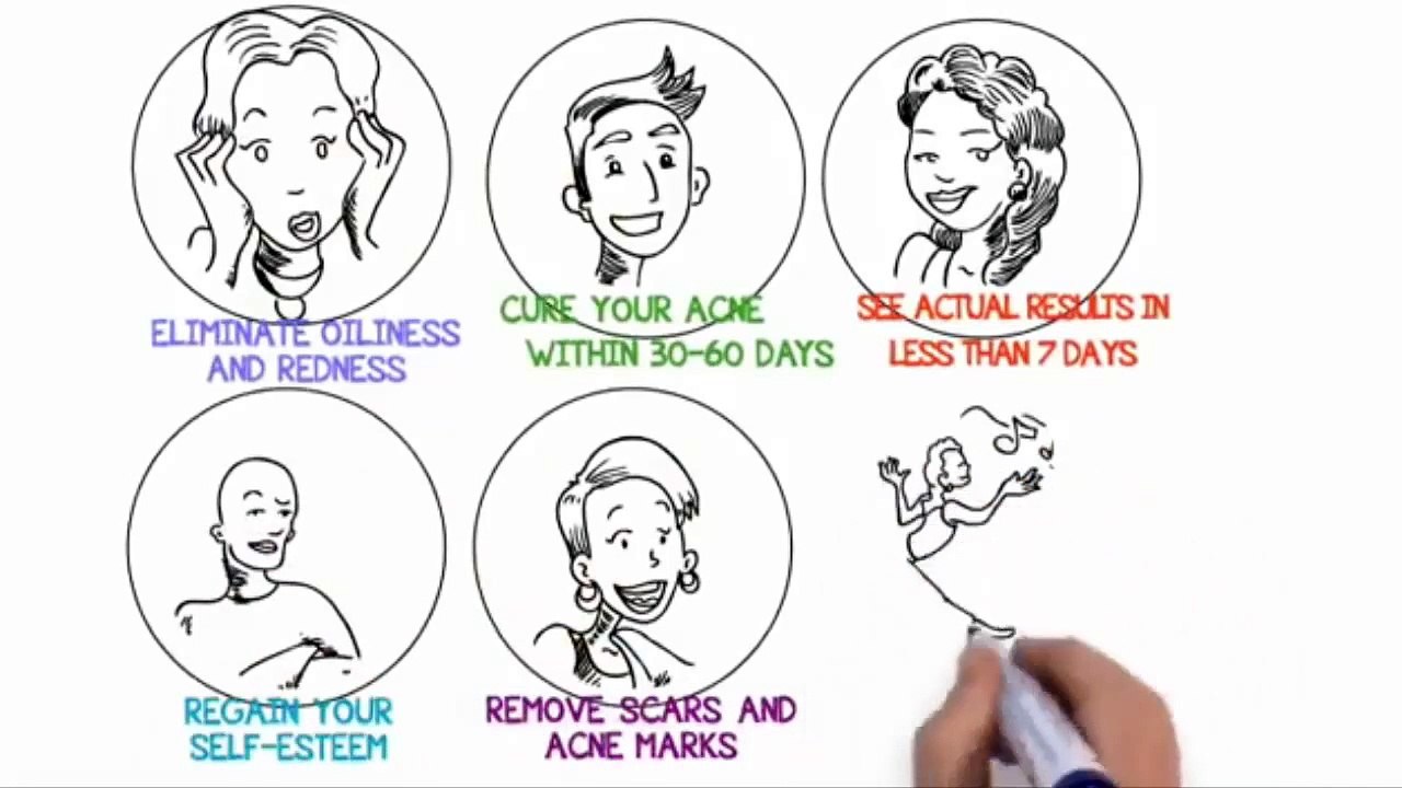 Acne No More Review - What Are the External Skin Care Secrets