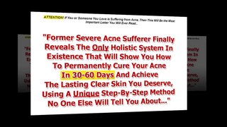 Best Acne No More Review _ How To Get Rid Of Acne Naturally