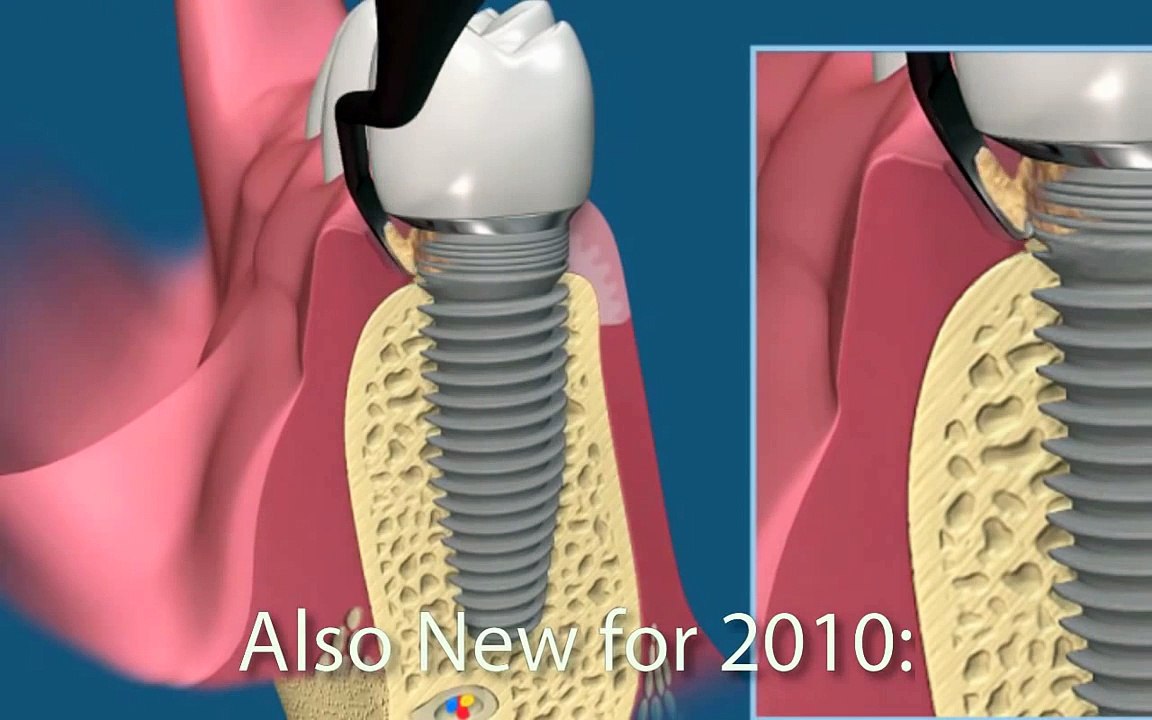 Consult-Pro Dental Patient Education Videos