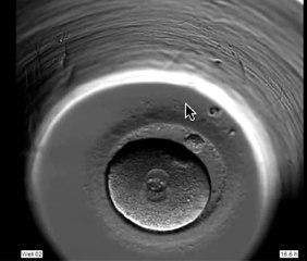 ivf embryo developing over 5 days by fertility Dr Raewyn Teirney