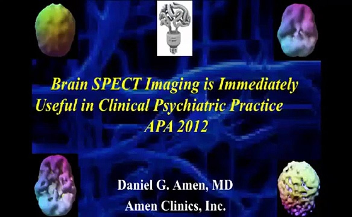Dr. Daniel Amen | Brain SPECT Imaging - Psychiatry's Tool to Save Lives
