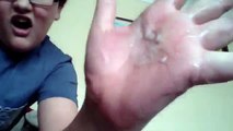 ME DOING THE SALT AND ICE CHALLENGE HURT LIKE HELL) [Mirror]