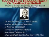 periodontics,gum disease,inflamed gums in Los Angeles
