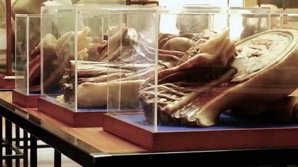King's College London: Gordon Museum of Pathology