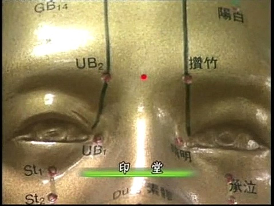 DIY 糖尿病防治保健推拿 (6) 常用穴位介绍