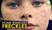 Freckles - Home Remedies | Health Tone Tips