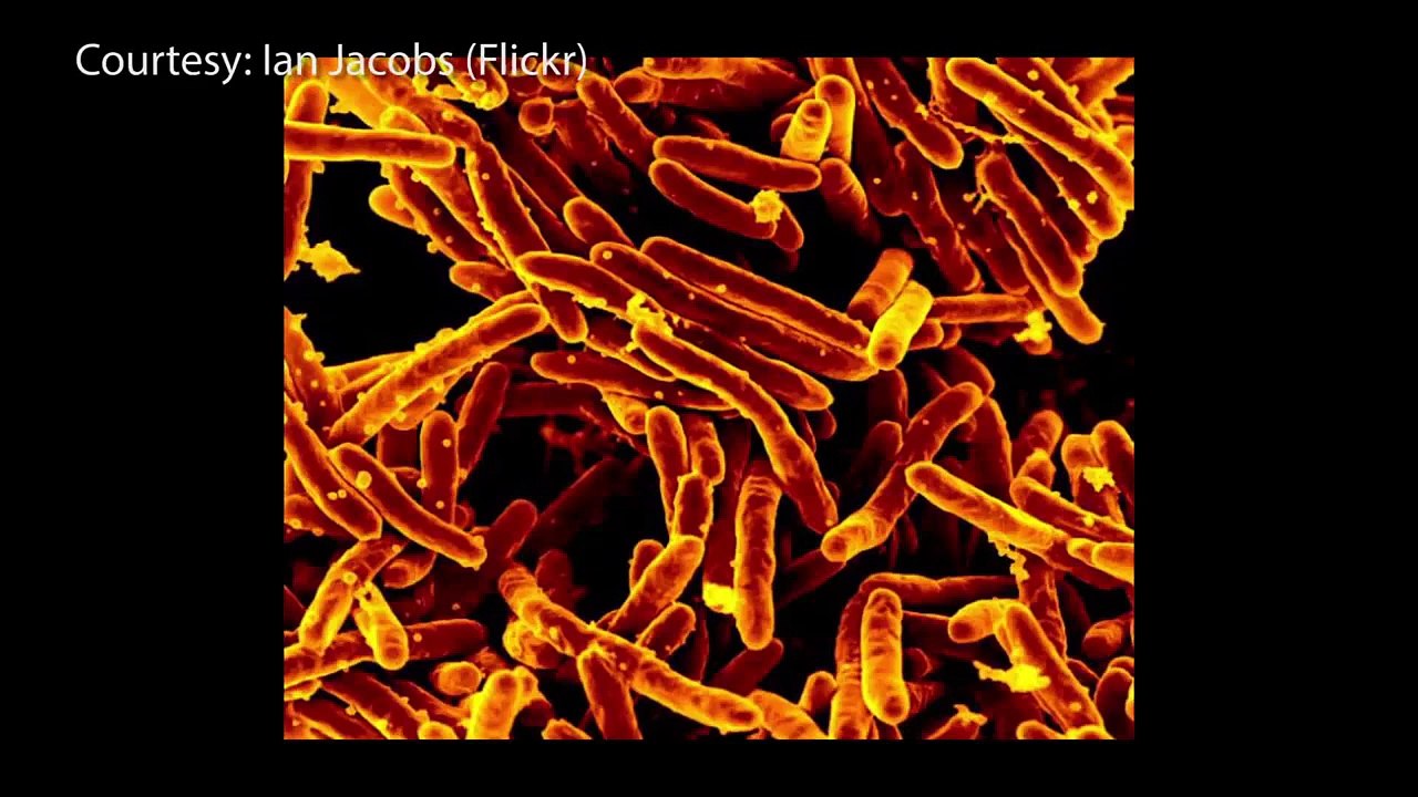 Trade and Migration Leave Border States Vulnerable To Infectious Disease
