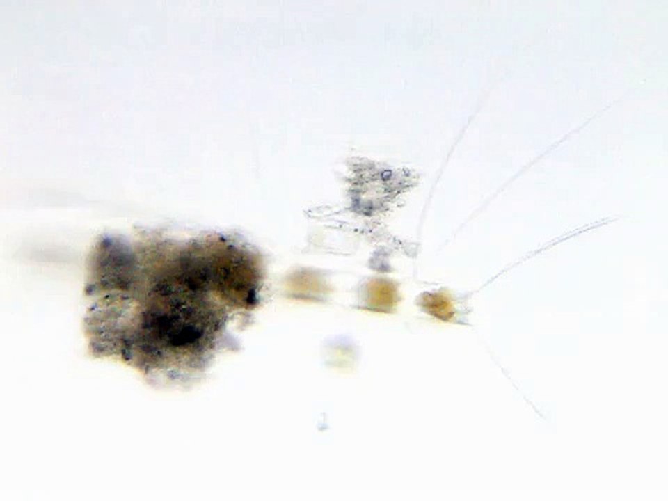 Chaetoceros (Diatom) #004