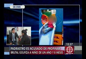 Acusan a padrastro por agresión contra bebe de un año 8 meses