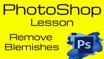 PhotoShop Lessons: Learn how to remove blemishes and Acne from your photos
