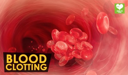 Signs Of Excessive Blood Clotting | Health Tone Tips