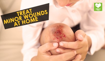 Treat Minor Wounds At Home | Health Tips | Education