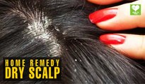 Dry Scalp (सूखी सिर की त्वचा) - Home Remedies | Health Tips | Educational Video