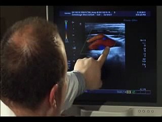 Carotid Artery Ultrasound