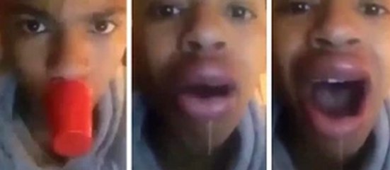 Kylie Jenner Lip Challenge Fail Compilation