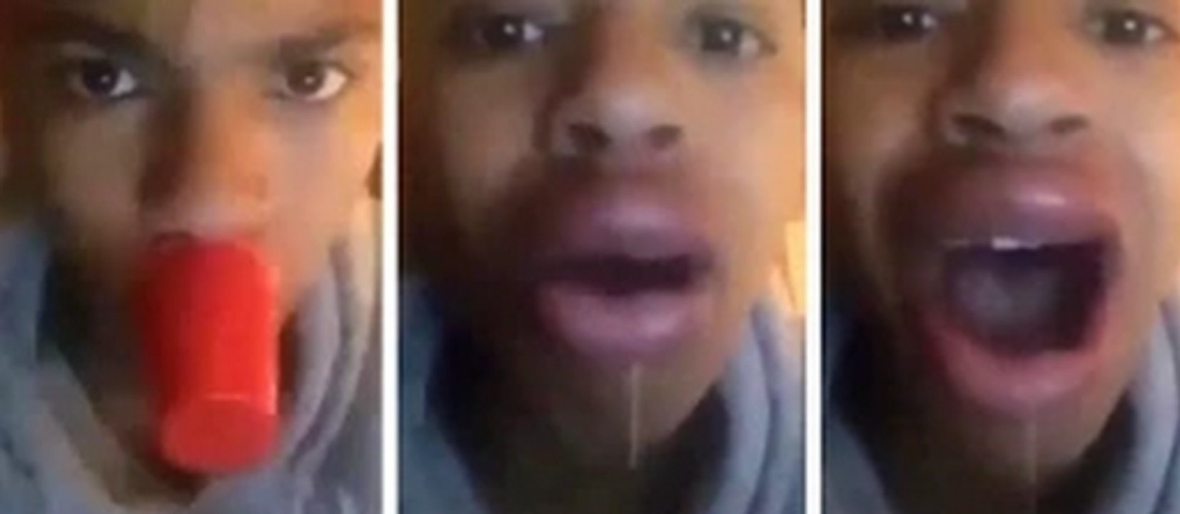 Kylie Jenner Lip Challenge Fail Compilation