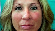 Hypothyroid & Chemo: 'Excited!' Kansas City Permanent Makeup http://www.painlessprogram.co