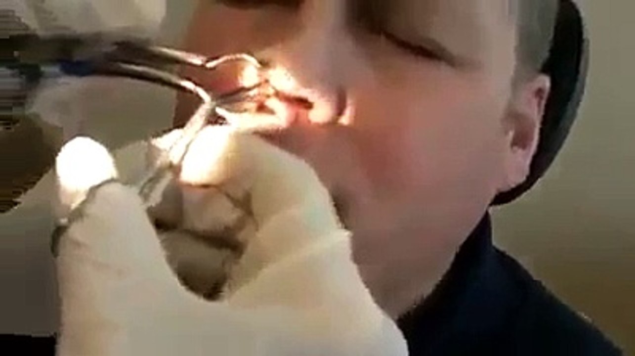 surgical operation