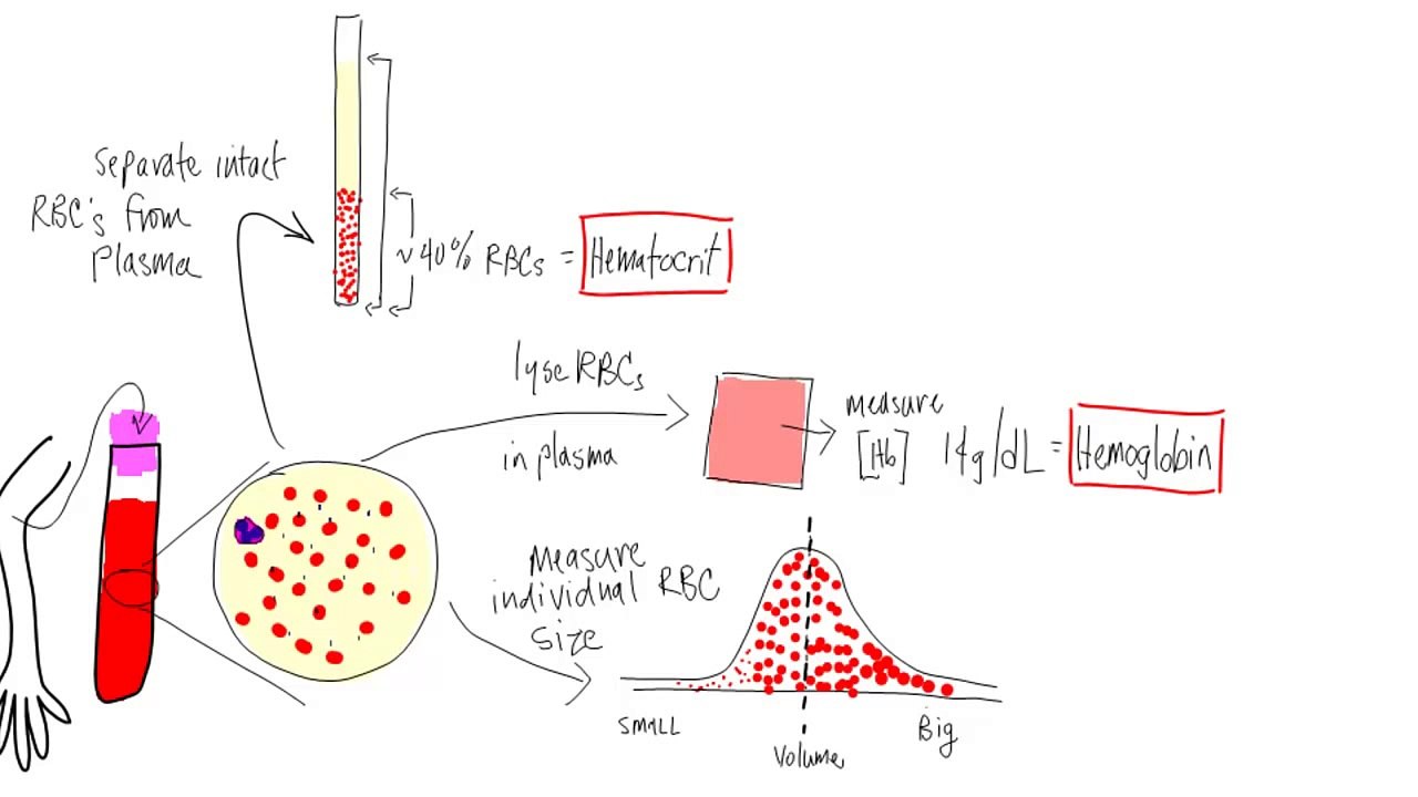 Anemia:  Basic lab tests - hematocrit, hemoglobin, reticulocyte, MCV, morphology