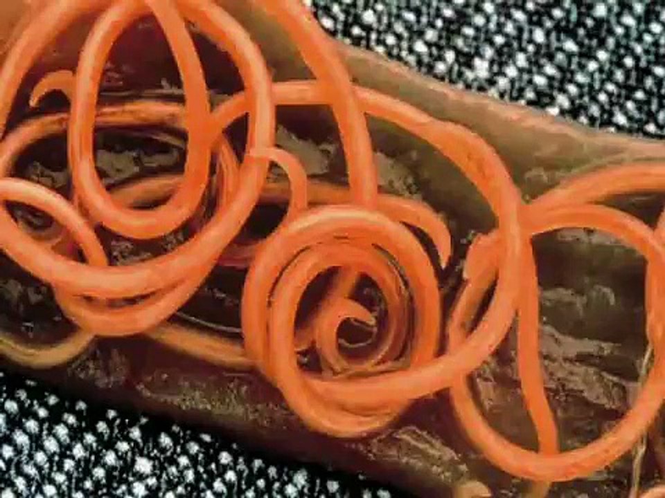 Worm Free Video