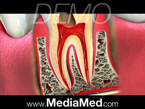 Tooth-Colored Fillings-Composite Fillings-Dental