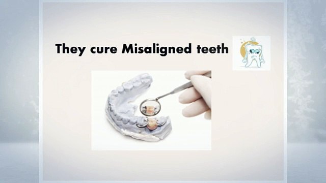 What orthodontists exactly do?