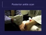 Musculoskeletal Ultrasound: Evaluation of Ankle Tendons and Ligaments