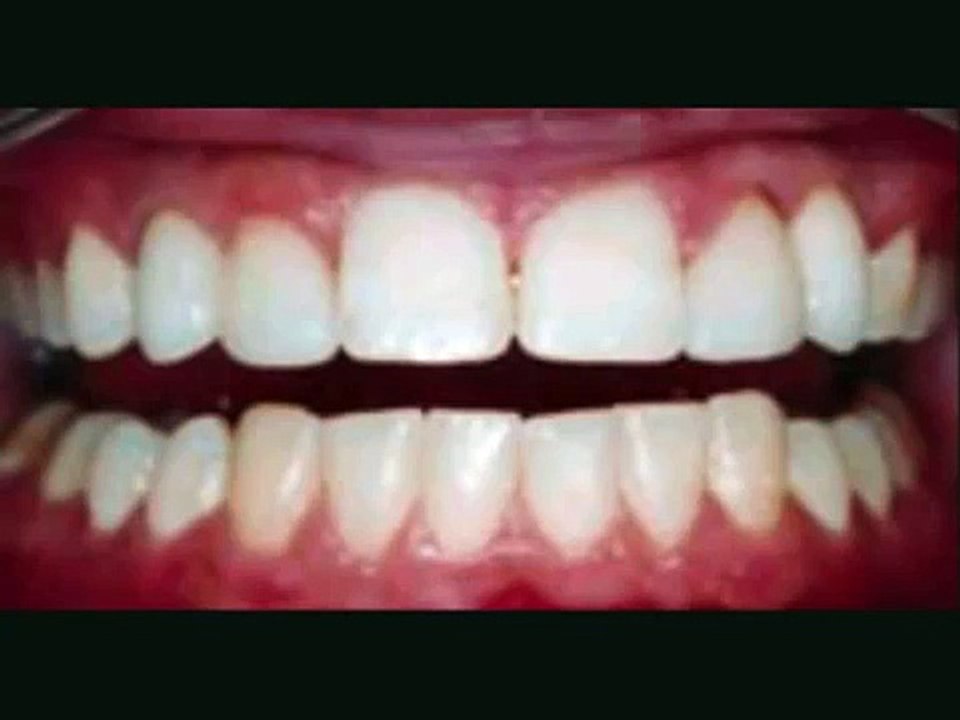 Cosmetic Dental Surgery : Beautiful results affordable dentistry