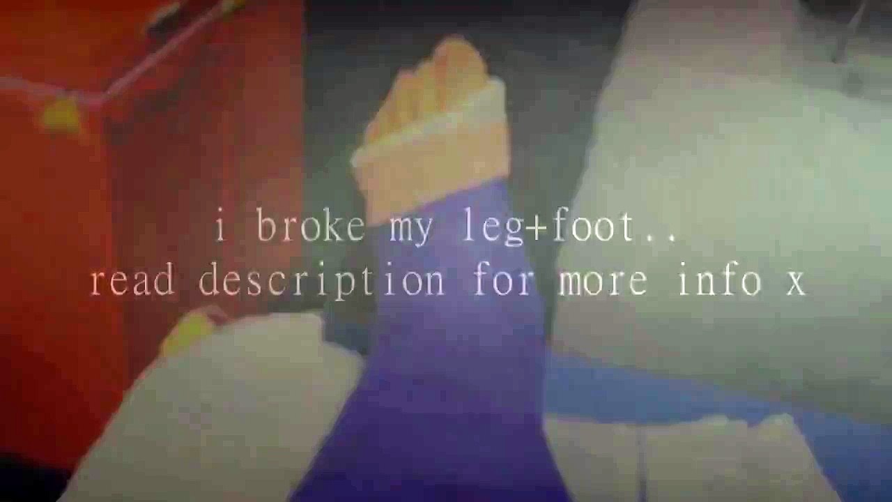 i broke my leg and foot!{read desc}